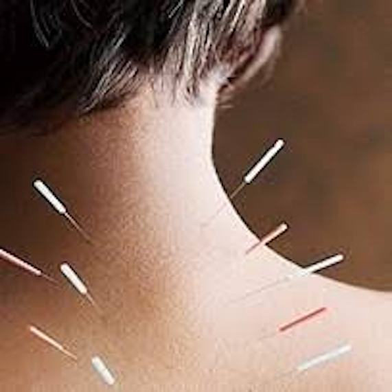 euromedica agopuntura estetica